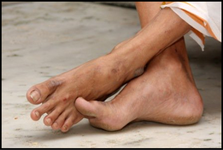 Sri Swamiji's holy feet